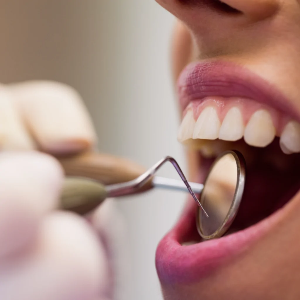 At YASMED Medical Center, our Dental Care Department provides comprehensive oral health services, including routine checkups, preventive care, and advanced dental treatments to ensure healthy teeth and gums.